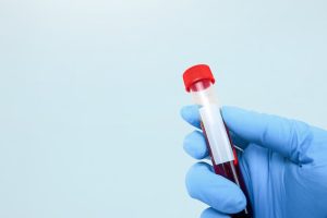 The cancer blood test making waves – and what the numbers really show